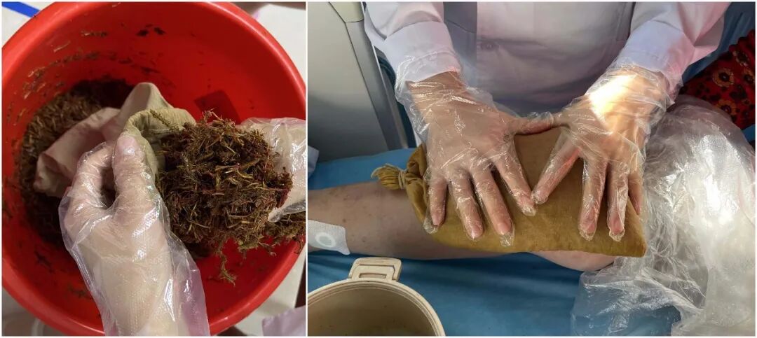 中医熨烫怎么中医特色熨烫，几十味中药融合，巧治常见病_https://www.jmylbn.com_新闻资讯_第4张