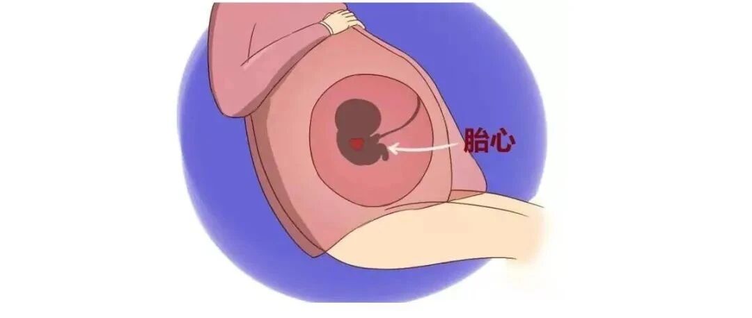 胎心停了会有什么症状