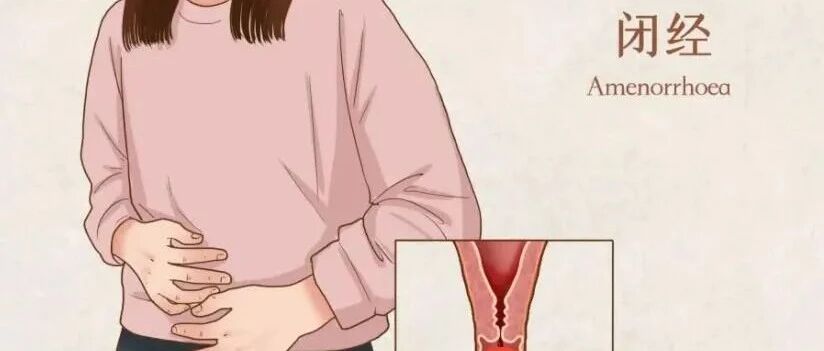 有腺肌症最晚多大年龄能闭经