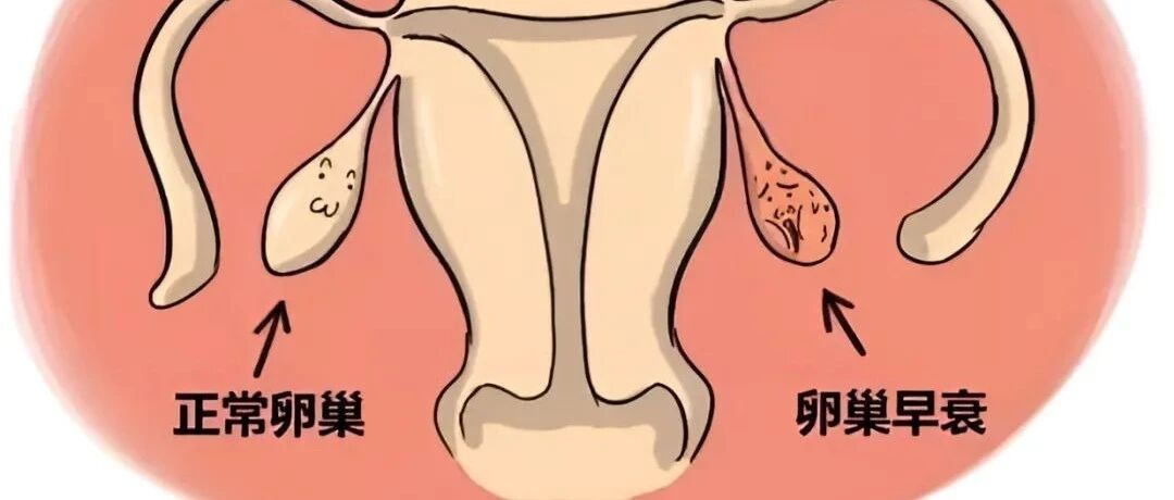 37岁卵巢早衰能治好吗？