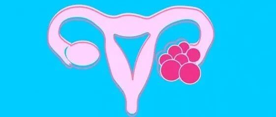 子宫里有囊肿怎么治疗