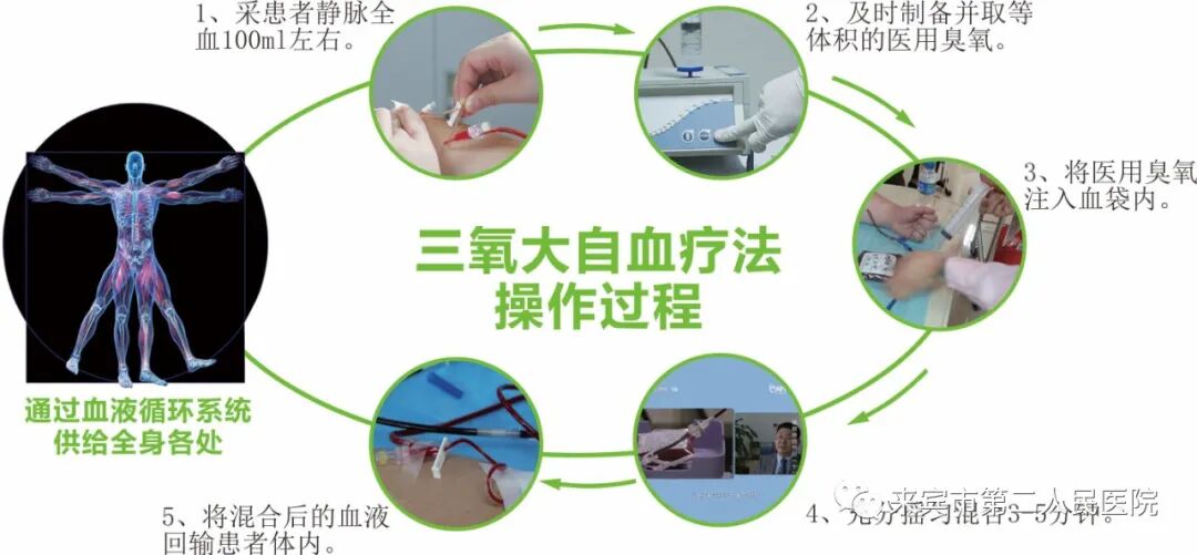 三氧疗法怎么代理来宾市第二人民医院——三氧大自血疗法_https://www.jmylbn.com_新闻资讯_第2张