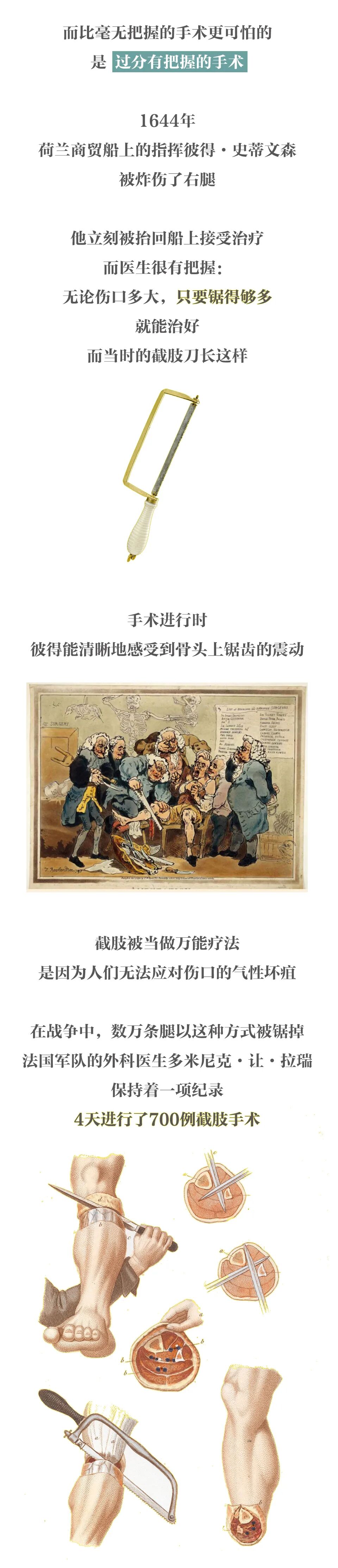 弯血管钳怎么读柳叶刀的历史！_https://www.jmylbn.com_新闻资讯_第5张