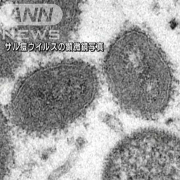 在日华人注意防疫！韩国、新加坡同时发现猴痘感染者！