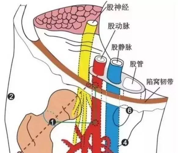 1,腹股沟韧带(图4