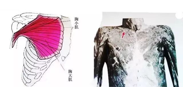 外展枕怎么使用总结的很全的针刀治疗要点，学针刀的人不容错过_https://www.jmylbn.com_新闻资讯_第30张