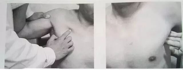 外展枕怎么使用总结的很全的针刀治疗要点，学针刀的人不容错过_https://www.jmylbn.com_新闻资讯_第39张