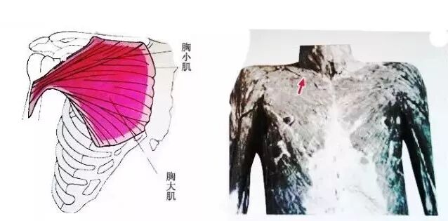 外展枕怎么使用总结的很全的针刀治疗要点，学针刀的人不容错过_https://www.jmylbn.com_新闻资讯_第38张