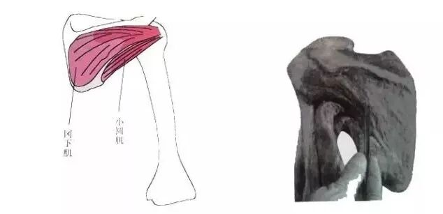 外展枕怎么使用总结的很全的针刀治疗要点，学针刀的人不容错过_https://www.jmylbn.com_新闻资讯_第43张