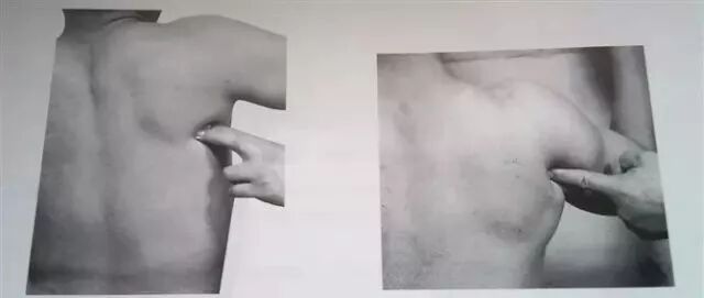 外展枕怎么使用总结的很全的针刀治疗要点，学针刀的人不容错过_https://www.jmylbn.com_新闻资讯_第34张