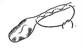 为什么要用皮钉缝合图文并茂丨外科各种缝合方法详解_https://www.jmylbn.com_新闻资讯_第19张