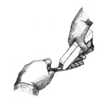 为什么要用皮钉缝合图文并茂丨外科各种缝合方法详解_https://www.jmylbn.com_新闻资讯_第22张