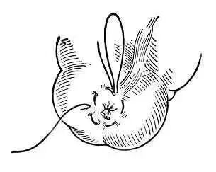 为什么要用皮钉缝合图文并茂丨外科各种缝合方法详解_https://www.jmylbn.com_新闻资讯_第11张