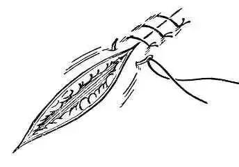 为什么要用皮钉缝合图文并茂丨外科各种缝合方法详解_https://www.jmylbn.com_新闻资讯_第1张