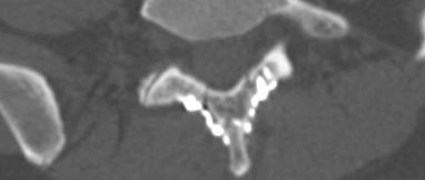 cover_image