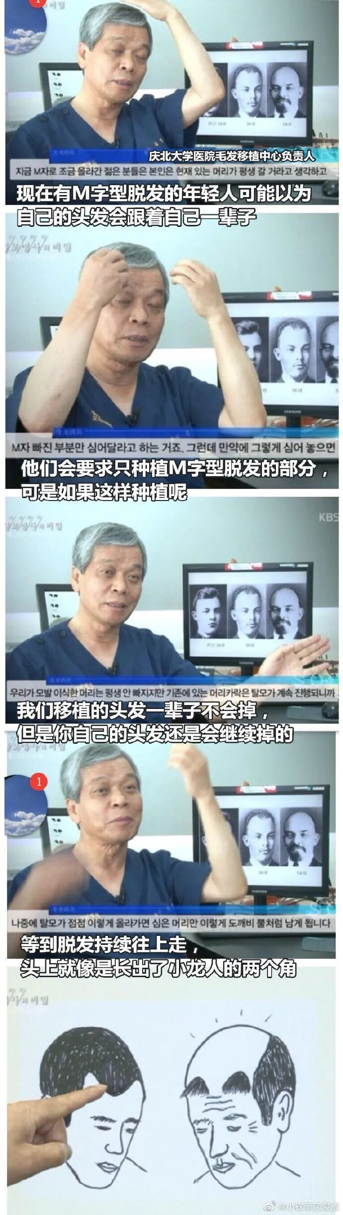 疤痕性体质抠了结痂_头皮结痂又抠掉又结痂怎么治_头皮结痂反复抠几年了