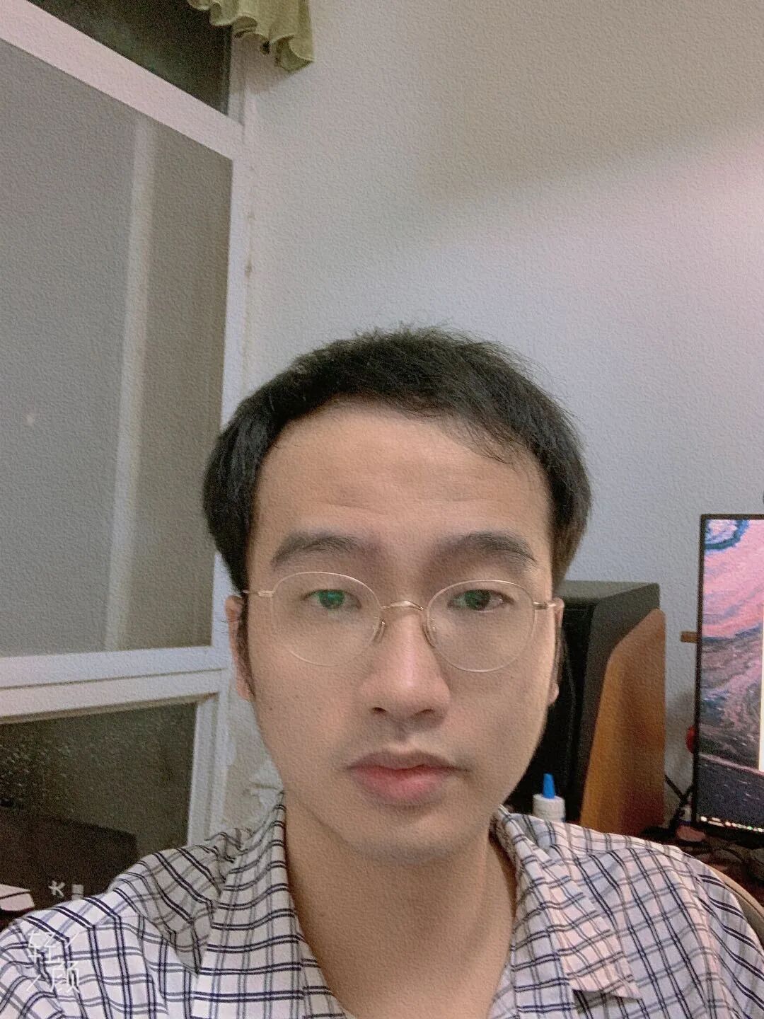 头皮结痂反复抠几年了_疤痕性体质抠了结痂_头皮结痂又抠掉又结痂怎么治