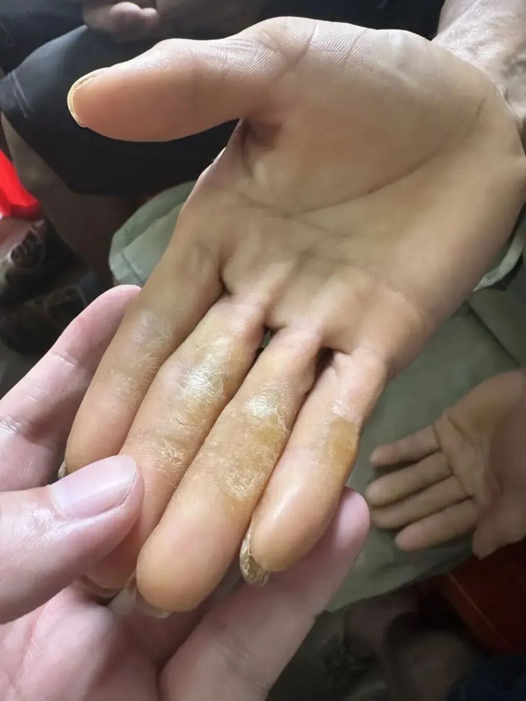 智障工人困在砖厂:月搬68万块砖