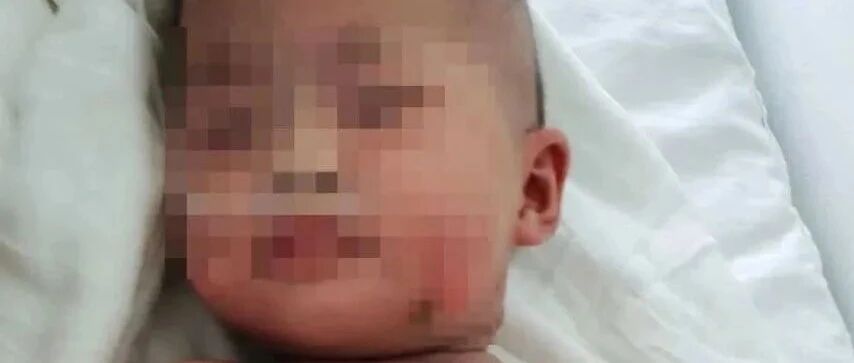 揪心！6个月大女婴被烫伤，妈妈一个动作孩子进了ICU…