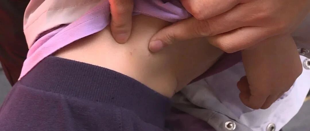 南宁5岁男童在小区里被狗咬伤整夜做噩梦，狗主人：就像蚊子叮了一下嘛