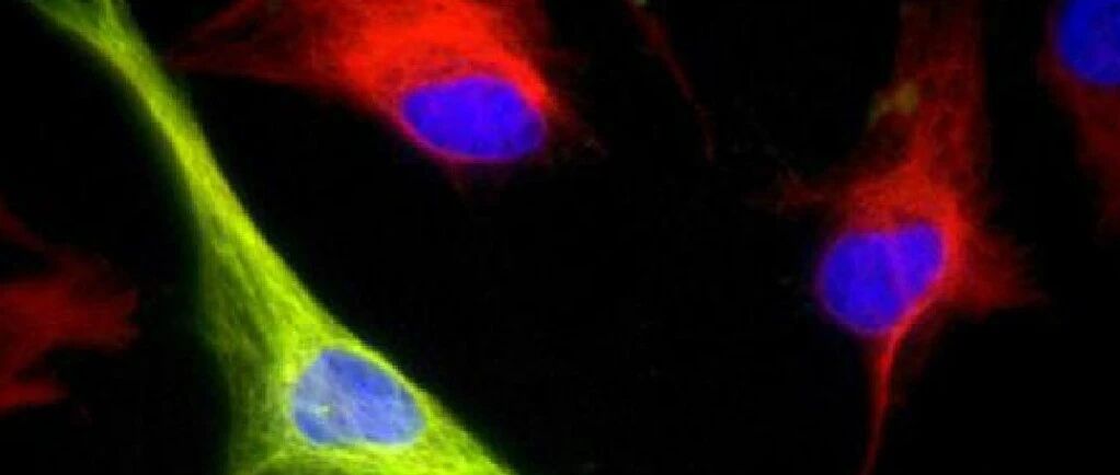 肿瘤标志物在肺癌免疫治疗中的研究进展