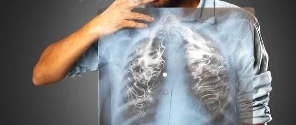 戒烟会导致肺癌吗？