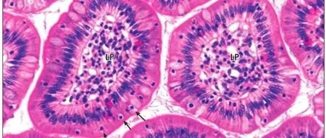 乳腺癌与甲状腺癌双原发的临床特征及预后