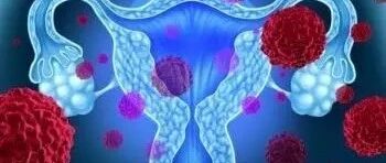 外泌体在卵巢癌诊疗中的研究进展