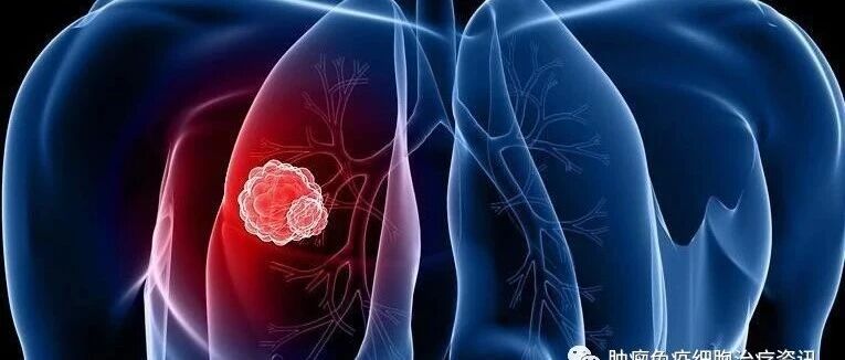 192Ir近距离治疗在局部复发非小细胞肺癌中的应用