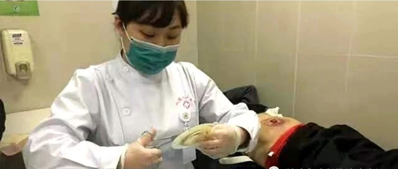 每年10万人失去肛门！这个能救命的检查，你千万别忽视！！！