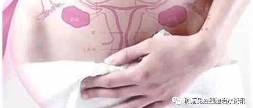 难治性宫颈癌的治疗进展