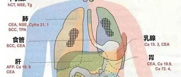 图解：常用肿瘤标志物与应用误区