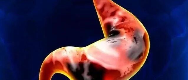 胃/胃食管结合部癌研究进展