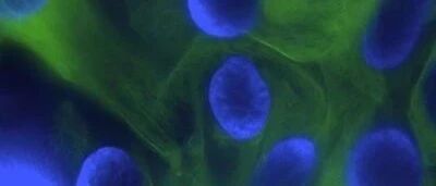 从机制出发，综述PARP抑制剂在前列腺癌中的临床研究进展