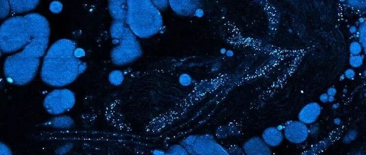 重离子束调节抗肿瘤免疫效应及与免疫疗法联合应用的基础研究进展