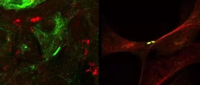 下呼吸道菌群失调与肺癌发生发展关系的研究进展