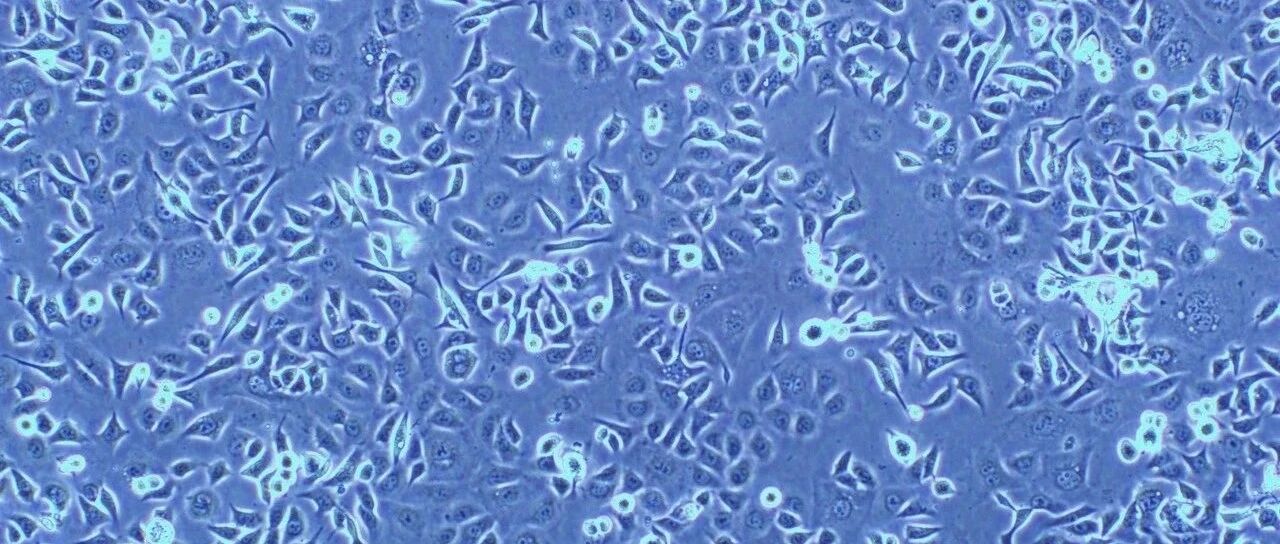 从循证中来，到临床中去探索CRC更优一线治疗方案