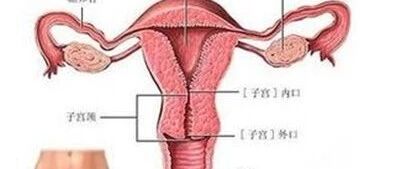 揭秘妇科“第一凶癌”卵巢癌