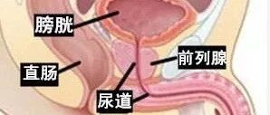 关于前列腺癌，你必须知道的那些事！
