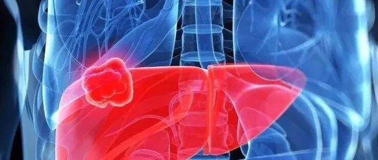 北京协和医院赵海涛团队，发表免疫立体治疗3.0——一个新时代的开启