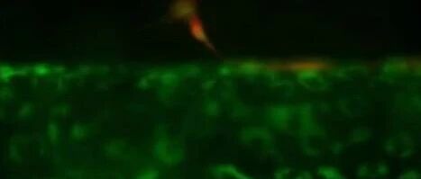 肿瘤微环境与细胞代谢共生