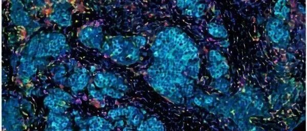 肿瘤微环境形成生理屏障阻止化疗药渗透进入肿瘤组织，且促肿瘤增殖