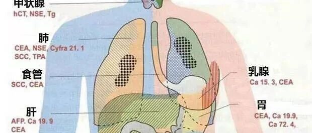 图解：常用肿瘤标志物与应用误区