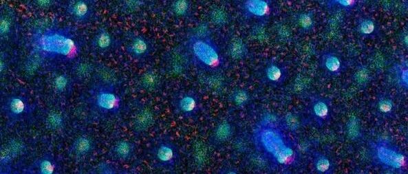 由ROS1汇总分析数据看Entrectinib出众的整体疗效和颅内获益