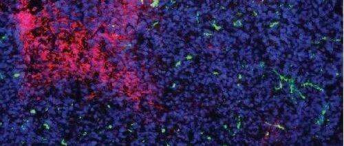 肿瘤患者与维生素B1摄入