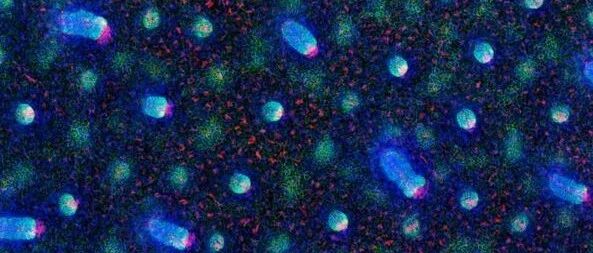 肺微生物组群与肺癌相关性研究进展