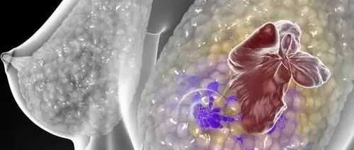 乳腺癌免疫治疗及免疫生物标志物研究进展