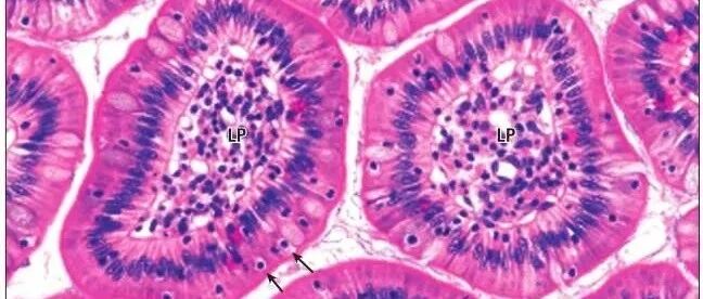 免疫治疗联合放化疗治疗非小细胞肺癌的临床研究进展