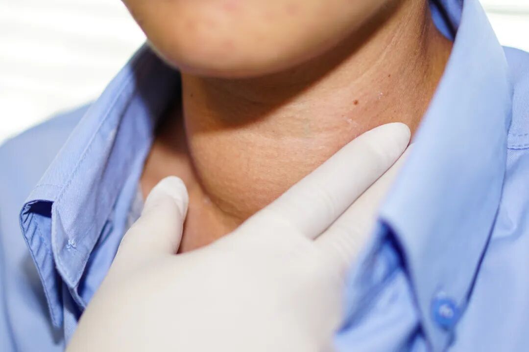 摄图网_326431847_亚洲女性患者喉部甲状腺功能亢进 甲状腺功能亢进 异常增大 健康强健的医学理念（企业商用）.jpg