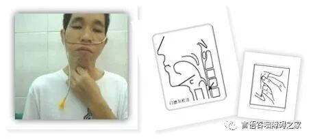 为什么要做吞咽仪器吞咽技术策略（一）_https://www.jmylbn.com_新闻资讯_第2张